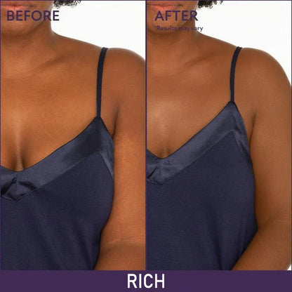 ✨HOT SALE 49% OFF✨🎄Soft Matte Cream Concealer