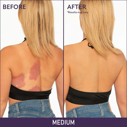 ✨HOT SALE 49% OFF✨🎄Soft Matte Cream Concealer