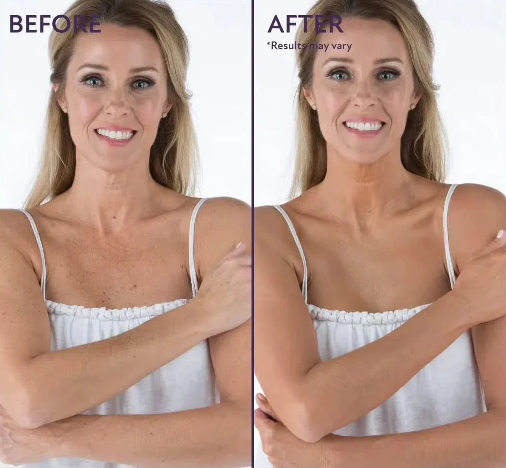 ✨HOT SALE 49% OFF✨🎄Soft Matte Cream Concealer