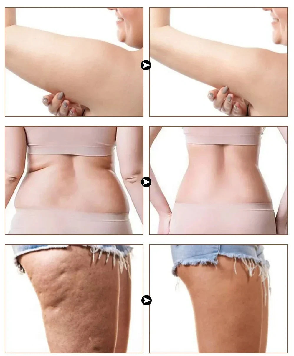 Final 3 Hours: 60%OFF🔥Naturals Cellulite Massage Oil