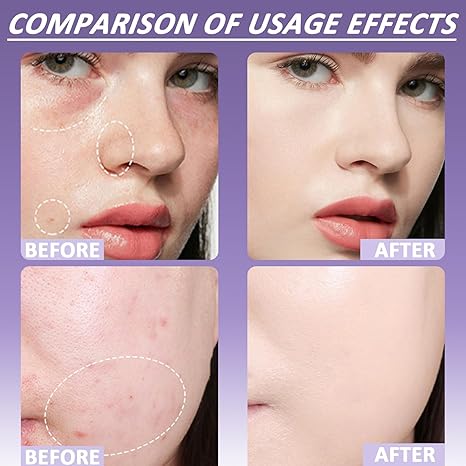 ✨HOT SALE 49% OFF✨🎄Soft Matte Cream Concealer