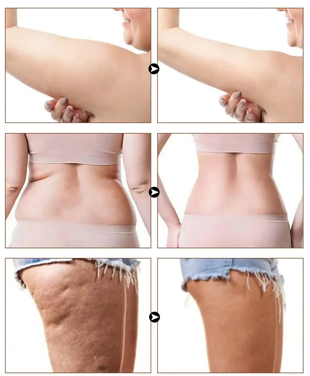 💎Final 3 Hours: 60%OFF🔥Naturals Cellulite Massage Oil